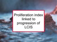 Proliferation linked to LCIS progression