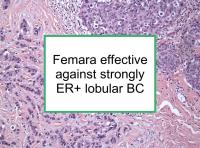 Femara effective for strongly ER+ lobular BC