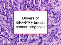 Drivers of ER+/PR+ breast cancer prognosis