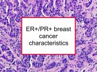 ER+/PR+ breast cancer characteristics