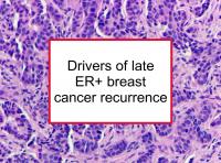 Drivers of late ER+ breast cancer recurrence