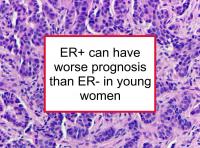 ER+ can have worse prognosis than ER- in young women