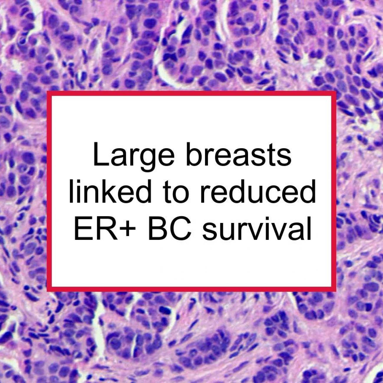 Bmi for large breasts Large Breast Size Linked To Reduced Survival For Er Breast Cancer Food For Breast Cancer