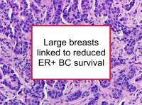 Survival analyses for breast cancer mortality by breast volume (bra cup