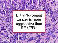 ER+/PR- BC is more aggressive than ER+/PR+