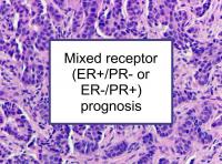 Mixed receptor (ER, PR) prognosis