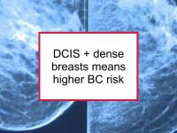 DCIS + dense breasts means higher BC risk