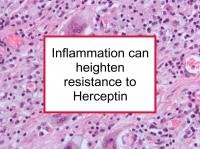 Inflammation can heighten resistance to Herceptin