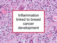 Inflammation linked to breast cancer development