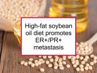 High-fat soybean oil diet promotes ER+/PR+ metastasis