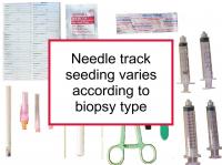Needle track seeding varies according to biopsy type