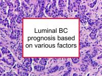 Luminal BC prognosis varies