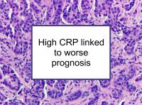 High CRP linked to worse prognosis
