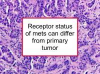 Receptor status of metastases can differ