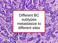 BC subtypes metastasize to different sites