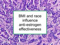 BMI and race influence anti-estrogen effectiveness
