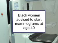 Black women should start mammograms at age 40