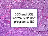 DCIS and LCIS normally do not progress to BC