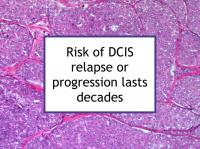Risk of DCIS relapse or progression lasts decades