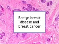 Benign breast disease and breast cancer