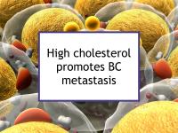 High cholesterol promotes BC metastasis