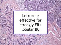 Letrozole effective for strongly ER+ lobular BC